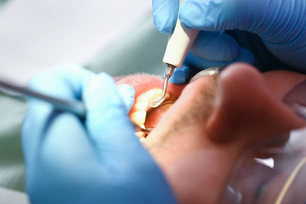 Best Emergency Dental Care for Abscessed Tooth in Manchester Center, VT